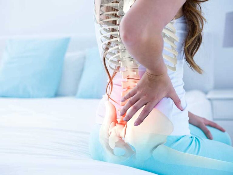 Donna si sostiene la schiena con una mano a causa di un’ernia del disco.